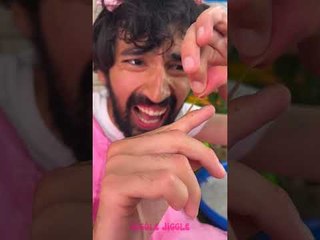 She REMOVED his HANGNAIL! But.. 🖐💀 #comedy #shorts