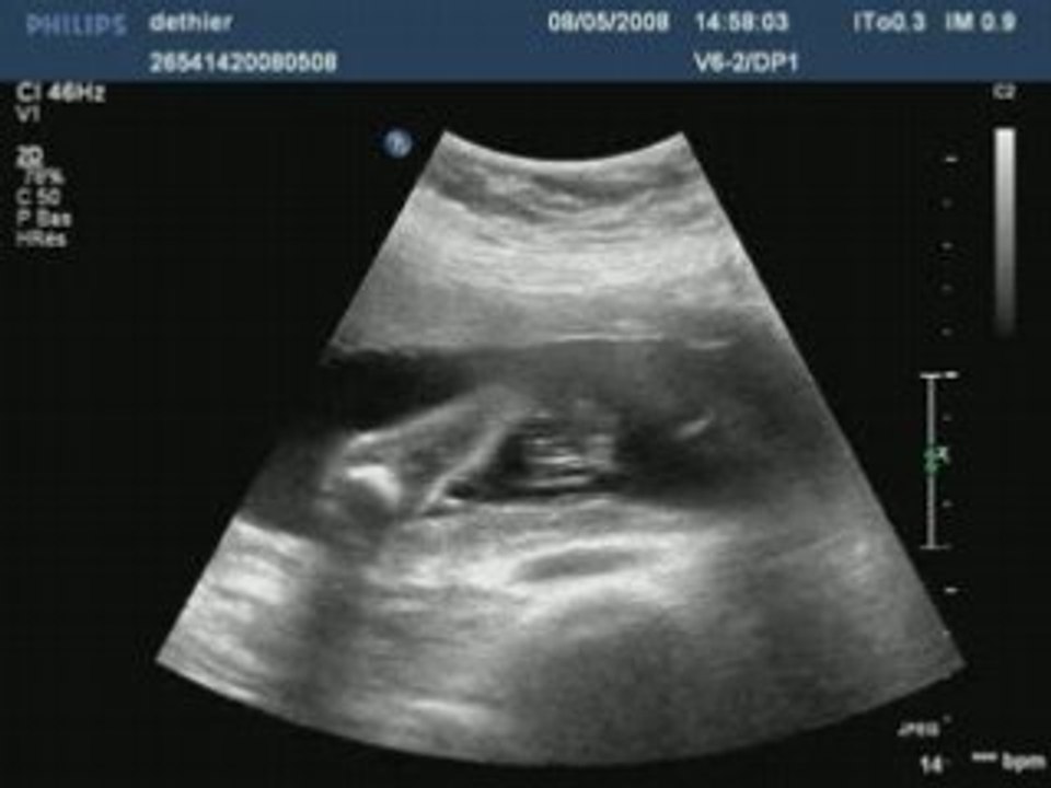 Dethier20080508145803714