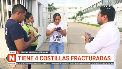 tiene 4 costillas fracturadas