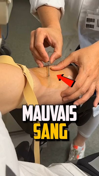 SI ON TE TRANSFUSE LE MAUVAIS SANG ?