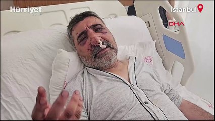 İngiliz boksörün darbettiği taksici yaşananları anlattı