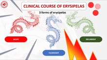 Forms of erysipelas from a clinical point of view