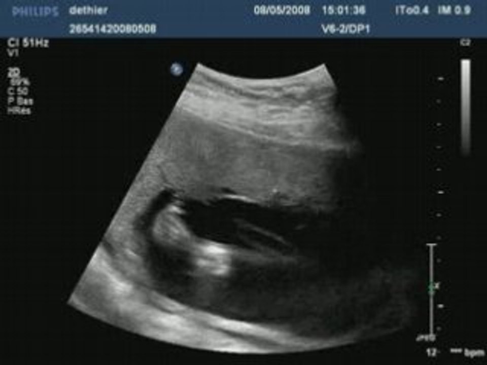 Dethier20080508150136346