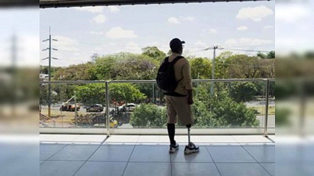 La fabricación de prótesis con impresión 3D del ITLA