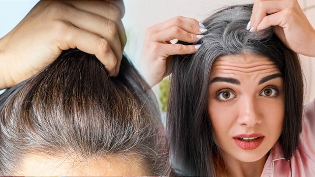 सामने के बाल सबसे पहले सफेद क्यों होते है,कारण और इलाज | Frontal Hair Greying Causes & Treatment