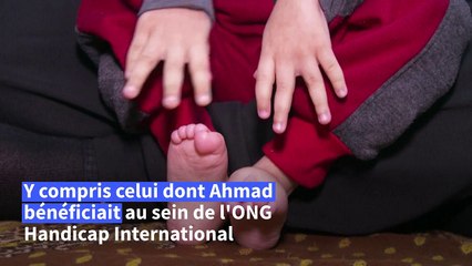 Jordanie: Ahmad, 5 ans, porteur d'un lourd handicap, souffre des coupes de l'aide américaine