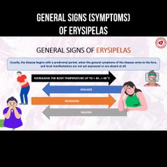 General signs (symptoms) of erysipelas