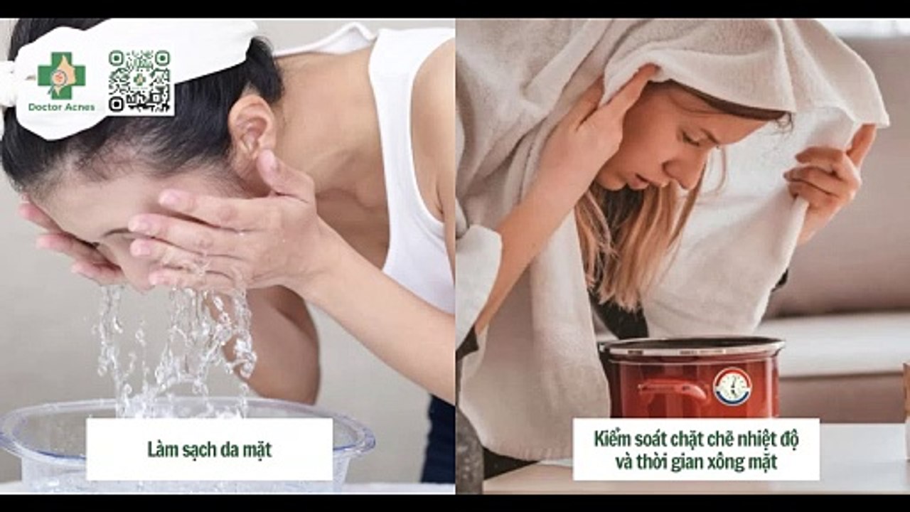 Cách xông mặt trị mụn cho da nhờn đơn giản tại nhà