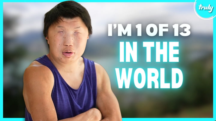 My Rare Condition Makes My Face Look Like A Mask | BORN DIFFERENT