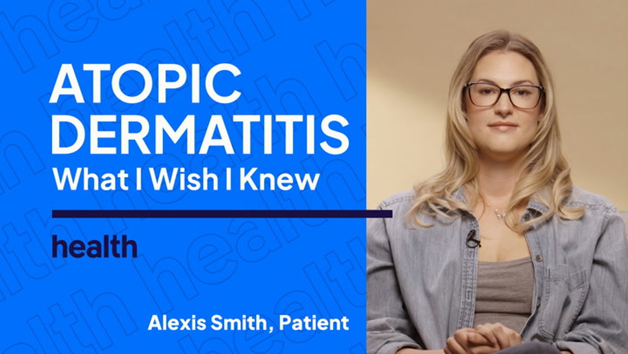 What I Wish I Knew about Atopic Dermatitis: Alexis