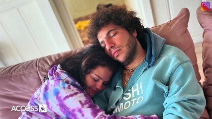 Why Selena Gomez’s First Kiss w_ Benny Blanco Gave Her A RASH