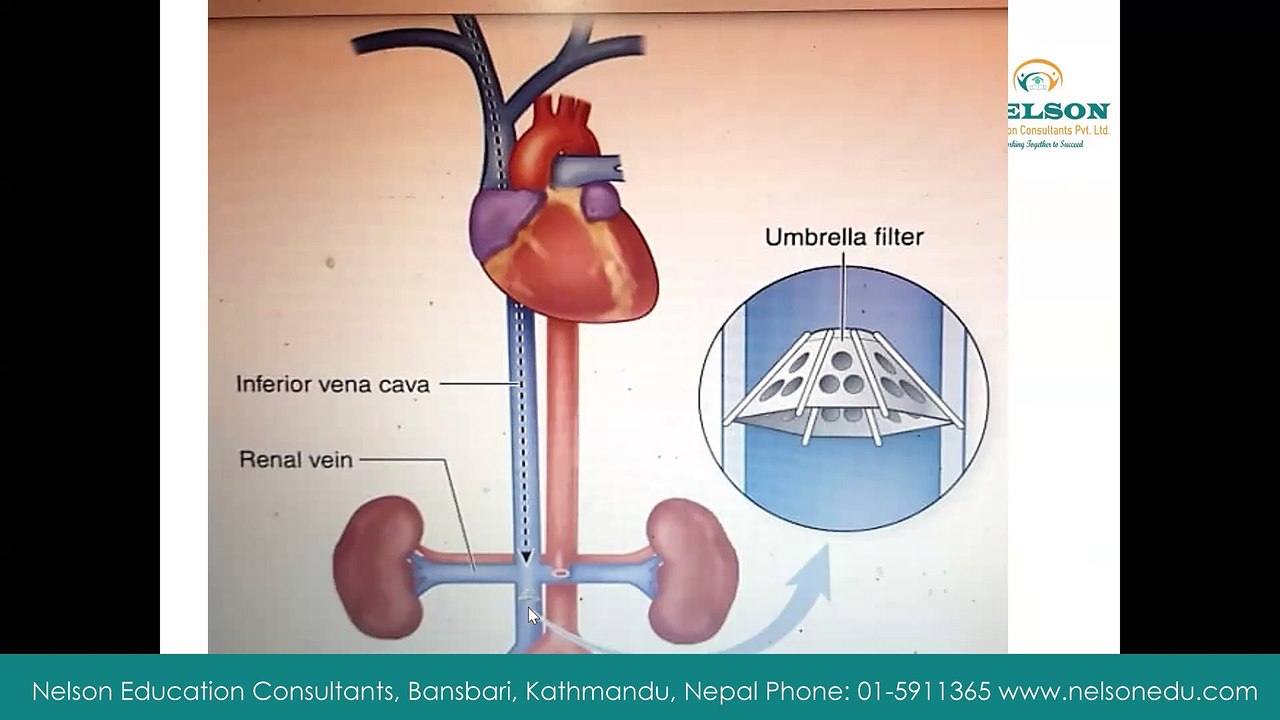Cardiovascular - arterial and venous disease