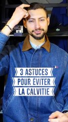 3 Astuces Infaillibles pour Prévenir la Calvitie 👦