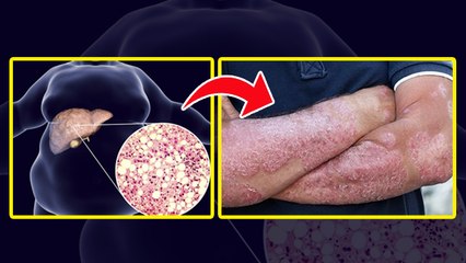 Fatty Acid Benefits: Body के लिए फैटी एसिड्स कितना जरुरी,फायदे और नुकसान | Boldsky