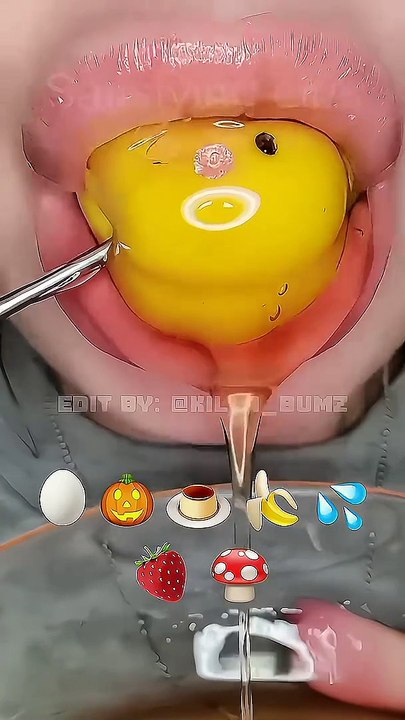 [ASMR] eating emoji 🍮 credits：__ @SatisfyingLips ｜｜ close req ｜｜ #eatingsounds #asmremoji