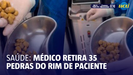 Urologista retira pedras de paciente que bebia 3l de refrigerante por dia