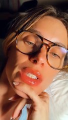 Carolina Dieckmann mostra alergia após viagem de avião e mostra preocupação: “Como vou gravar assim?”