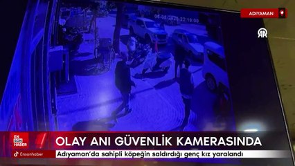 Adıyaman'da sahipli köpek, genç kıza saldırdı