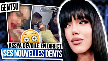 Assya se fait refaire les dents à Dubaï 👀