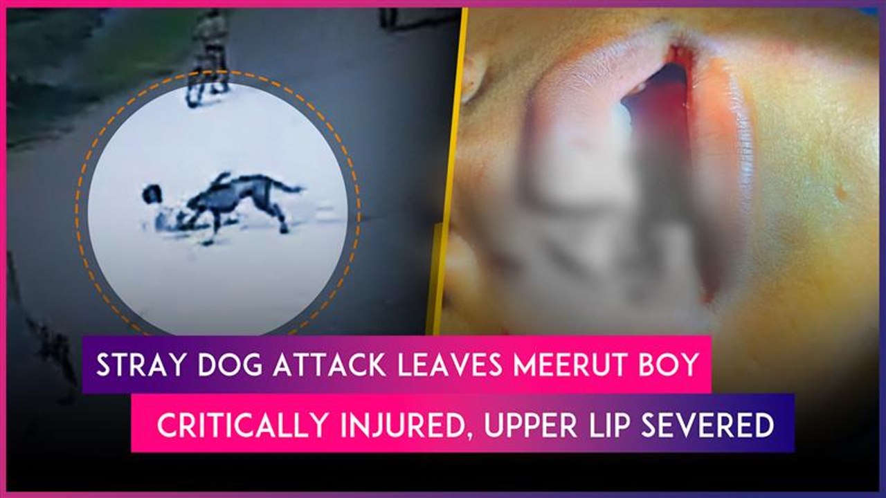 Stray Dog Mauls Boy, Chews Off His Upper Lip In UP’s Meerut; Angry Villagers Kill Canine