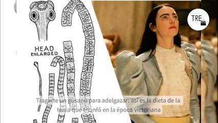 Tragarte un gusano para adelgazar: así es la dieta de la tenia que triunfó en la época victoriana