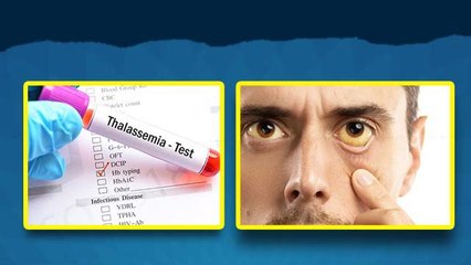 Thalassemia Test Before Marriage: शादी से पहले थैलेसीमिया टेस्ट कराना क्यों जरुरी है, Couple Health