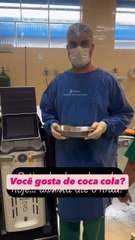 Médico se surpreende ao retirar 35 pedras de bexiga de paciente viciado em refrigerante