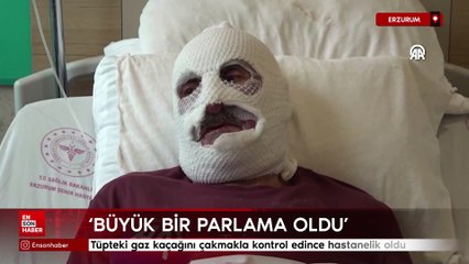 Erzurum'da tüpteki gaz kaçağını çakmakla kontrol edince hastanelik oldu