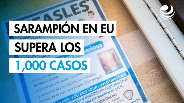 El brote de sarampión en Estados Unidos supera los 1,000 casos confirmados