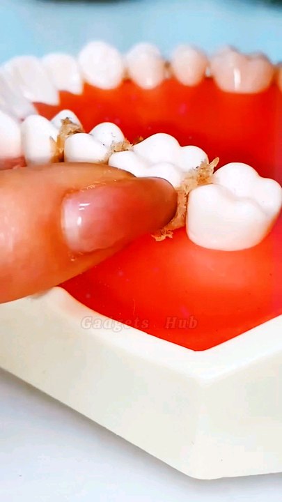 Teeth cleaning gadget 😯#shorts #viralvideo #video
