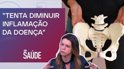 Importância da fisioterapia pélvica para tratamento da endometriose | JP SAÚDE
