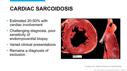 Name the Systemic Disease Echo Board Review