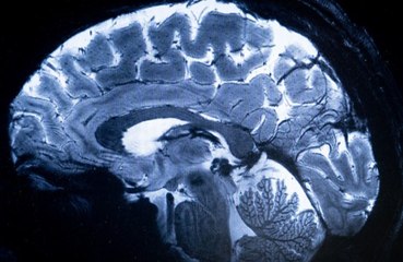 Curiosity could lower chances of dementia in later life