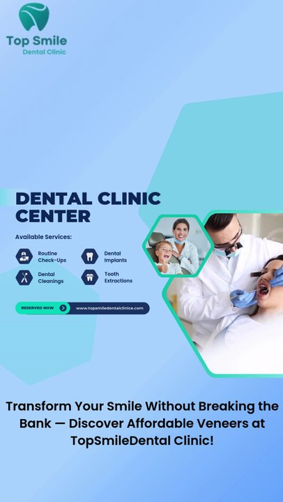 Transform Your Smile Without Breaking the Bank — Discover Affordable Veneers at TopSmileDental Clinic!