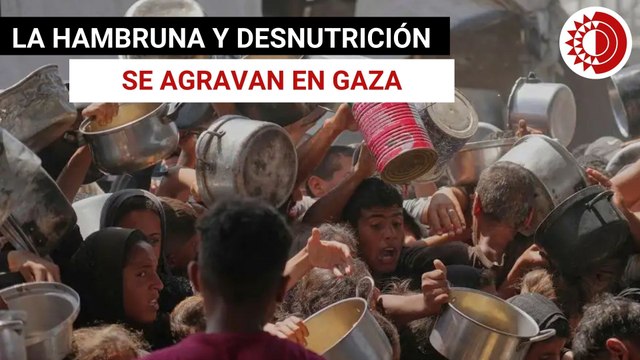 Hambruna y desnutrición se agravan en Gaza