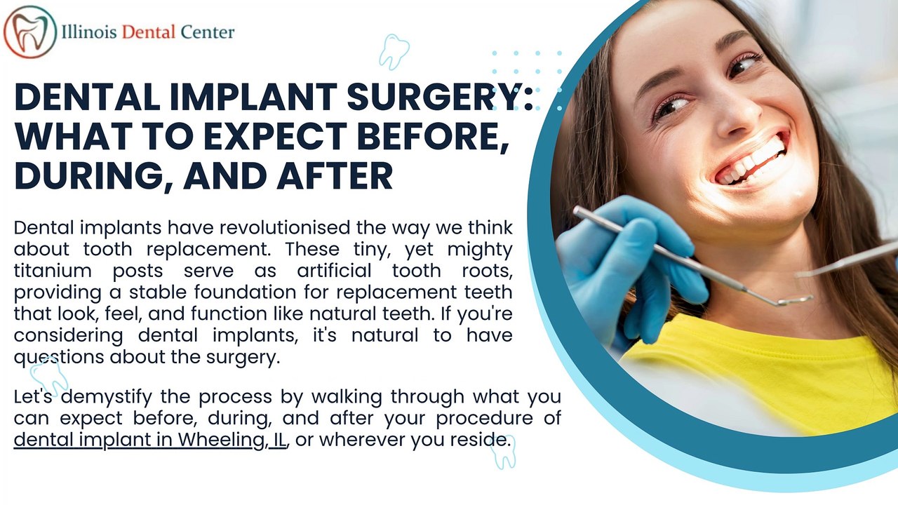 Dental Implant Surgery What to Expect Before, During, and After