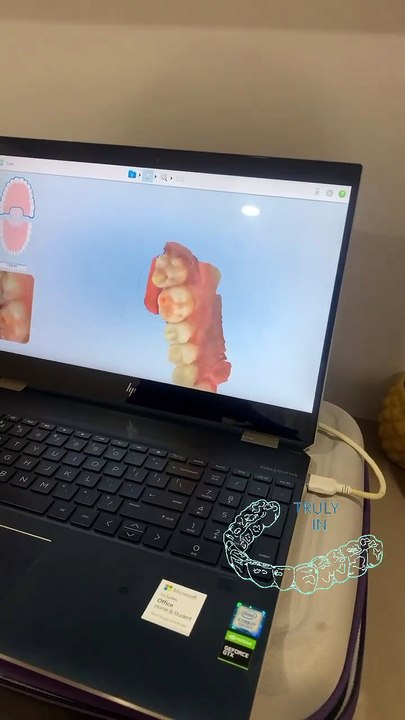 ou can be camera-ready with Invisalign clear aligners and smile with confidence!