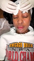 HydraFacial Elite Treatment at Derma Purity for Glowing Skin