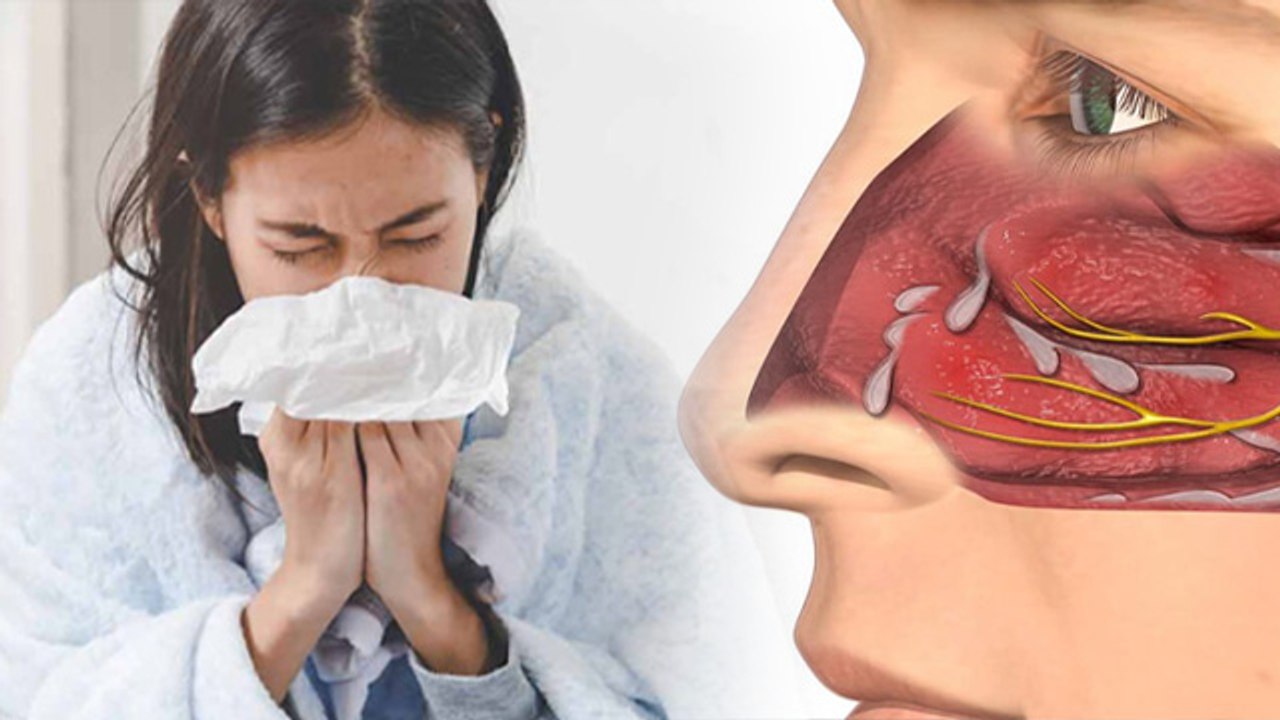 Cold-Cough Problems: Rhinitis Allergic क्या होता है,Reason, Symptoms & Treatment | Boldsky