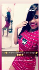 Yocairi Amarante, víctima del ácido del diablo sueña con volver a ser la misma