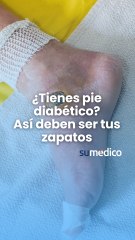 ¿Tienes pie diabético? Así deben ser tus zapatos
