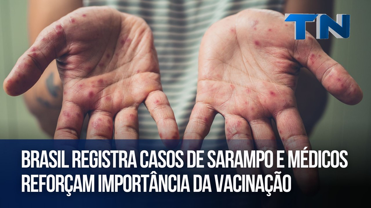 Brasil registra casos de sarampo e médicos reforçam importância da vacinação