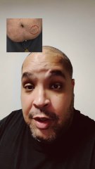 Baisse de moral ce soir #diabete #diabetique #obesite