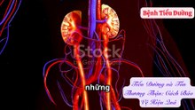 Tiểu Đường và Tổn Thương Thận Cách Bảo Vệ Hiệu Quả