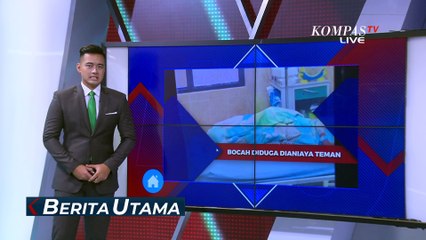 Bocah di Situbondo Disiram Spiritus, Polisi Periksa Teman Korban