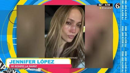 Jennifer Lopez sufre una aparatosa caída y se rompe la nariz