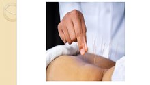 How Acupuncture Needles in Toronto Help Relieve Chronic Pain?