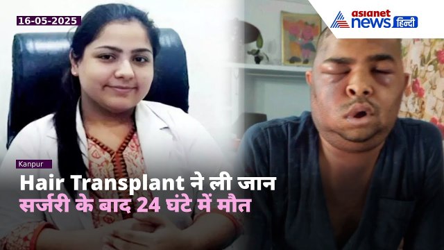 Hair Transplant बना जानलेवा! Kanpur में एक और इंजीनियर की मौत | Shocking Reality
