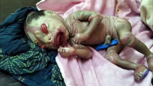 राजस्थान में महिला ने दिया ऐसे बच्चे को जन्म, जिसे देखकर डॉक्टर भी रह गए हैरान, बना चर्चा का विषय