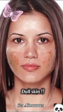 How to get clear skin with these simple Tips 🤯#clearskin #kpop #blackpink